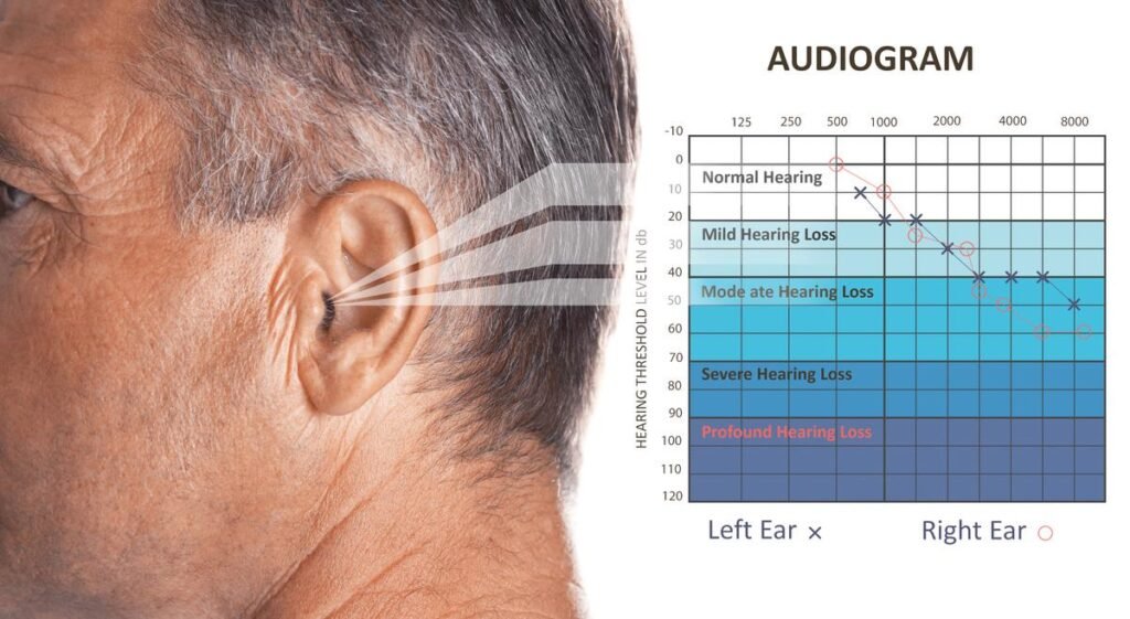 Age Related Hearing Loss